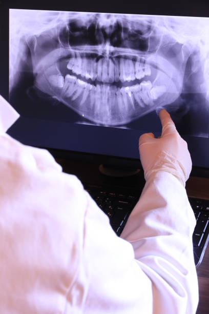 Best Emergency Root Canal Treatment in Aldine, TX