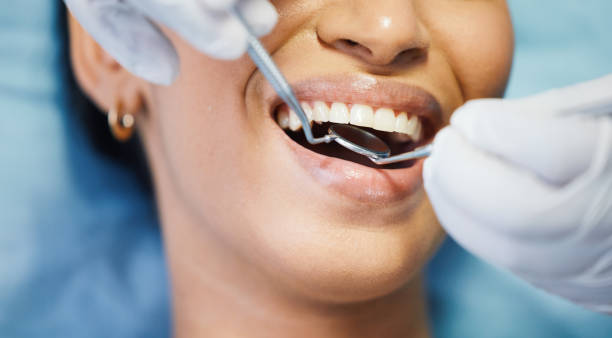 Best Emergency Dentist for Lost Fillings or Crowns in Aldine, TX